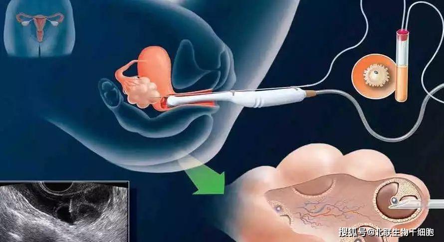 七个月宝宝腰软挺不直，原因、关注与改善策略