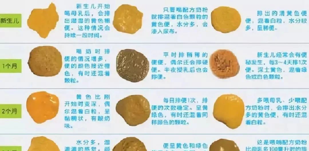 两个月宝宝大便酸臭的原因解析